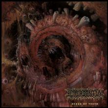 HYPERDONTIA  - CD NEXUS OF TEETH