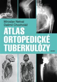  Atlas ortopedické tuberkulózy [CZ] - supershop.sk